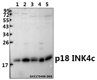 CE, ISO9001 Approved P18 Ink4c (D142) Polyclonal Antibody